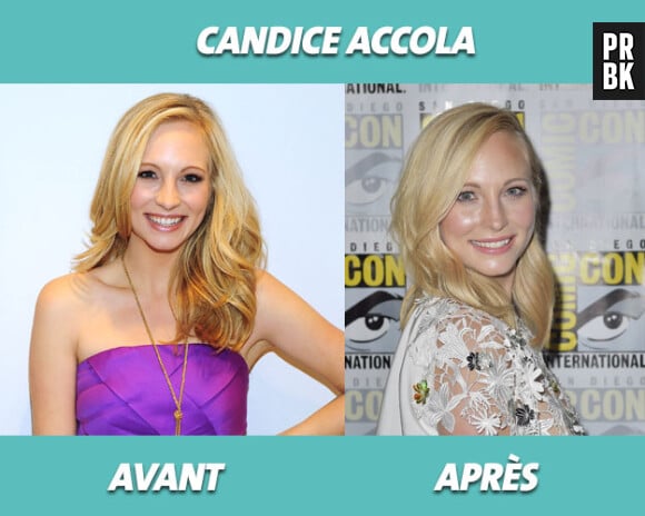 The Vampire Diaris : Candice Accola avant/après