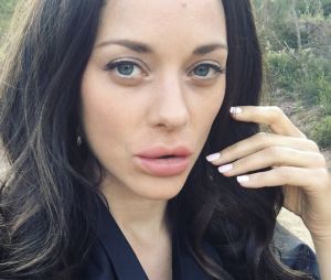 Marion Cotillard a-t-elle succombé à la chirurgie esthétique ? Les photos qui affolent la toile