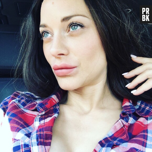 Marion Cotillard a-t-elle succombé à la chirurgie esthétique ? Les photos qui affolent la toile