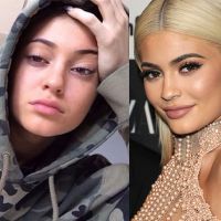 Kylie Jenner, Nabilla Benattia, Iris MIttenaere... Les stars sans maquillage