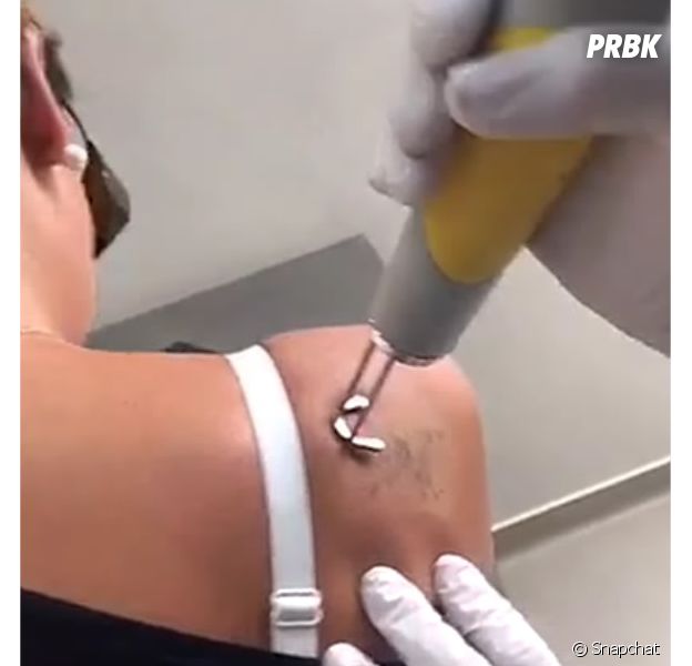 amelie neten se fait enlever deux tatouages sur snapchat purebreak
