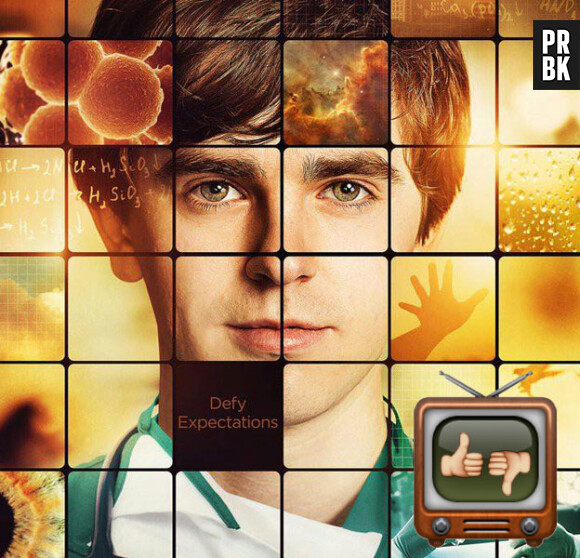 The Good Doctor : on mate ou on zappe la série avec Freddie Highmore ?