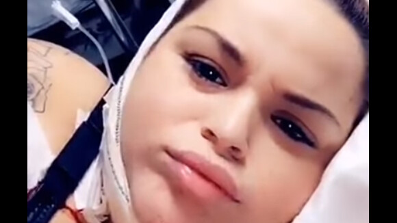 Sarah Fraisou dévoile son nouveau corps après une nouvelle chirurgie en Tunisie