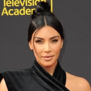 Kim Kardashian sans maquillage : elle assume ses boutons de psoriasis, les internautes valident