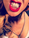 Rihanna dévoile ses fausses dents en diamant sur Instagram