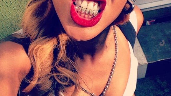 Rihanna : des Diamonds jusqu'au bout des dents