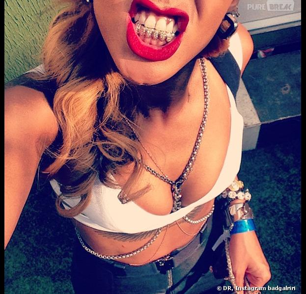 Rihanna dévoile ses fausses dents en diamant sur Instagram