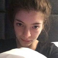 Lorde naturelle sur Instagram... même avec de l'acné