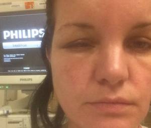Pauley Perrette victime d'une terrible allergie