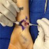 Miley Cyrus à l'hôpital : sa blessure au poignet parodiée sur Instagram