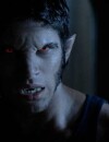  Teen Wolf saison 5 : Tyler Posey face &agrave; un nouveau loup-garou 