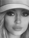 Kylie Jenner : elle avoue enfin avoir fait gonfler ses lèvres dans un épisode de KWTK