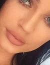  Kylie Jenner : elle a avoue enfin avoir fait gonfler ses l&egrave;vres dans un &eacute;pisode de KWTK 