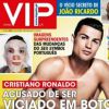 Le magazine VIP balance que Cristiano Ronaldo serait "addict" à la chirurgie esthétique.