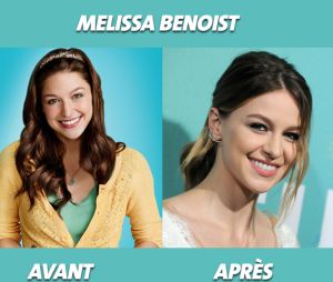 Glee : que devient Melissa Benoist ?