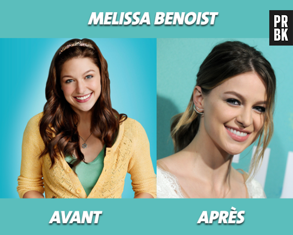 Glee : que devient Melissa Benoist ?