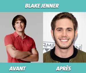 Glee : que devient Blake Jenner ?