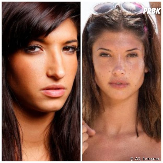 Mélanie Dedigama (Les Princes et les princesses de l'amour) avant/après la chirurgie esthétique