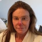 Caitlyn Jenner défigurée : elle plaisante sur son nez en sang suite à des cellules cancéreuses
