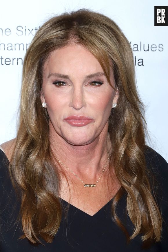 Caitlyn Jenner défigurée : le père de Kylie Jenner et de Kendall Jenner dévoile une photo choc avec le nez en sang !