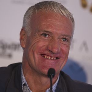 Didier Deschamps a refait ses dents : les internautes n'en croient pas leurs yeux