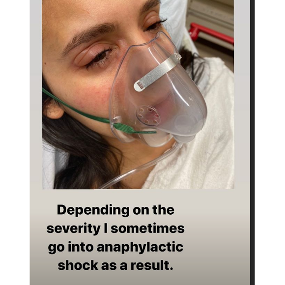 Nina Dobrev : les raisons de son hospitalisation dévoilées sur Instagram Stories