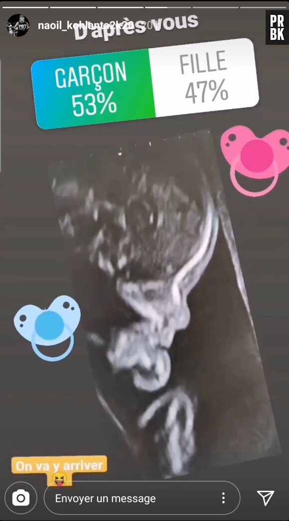 Koh Lanta 2020 (Koh Lanta, l'île des héros) : Naoil enceinte, l'aventurière dévoile le sexe du bébé sur Instagram