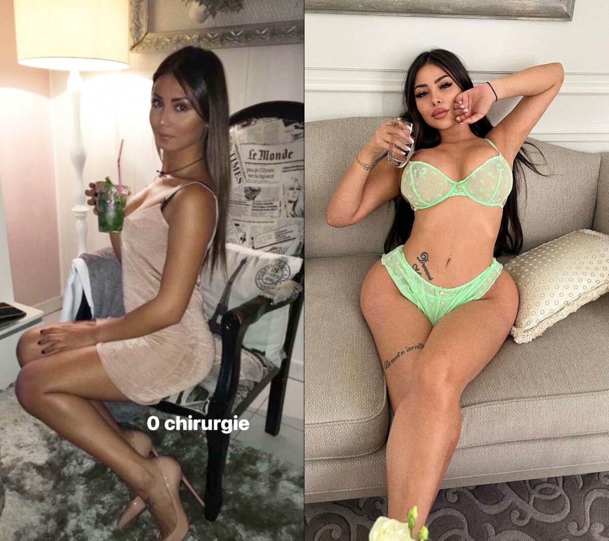 Photo Maeva Ghennam avant et après la chirurgie PureBreak