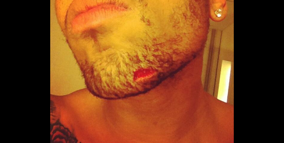 Chris Brown s&#039;est fait taillader le visage par la team de Drake