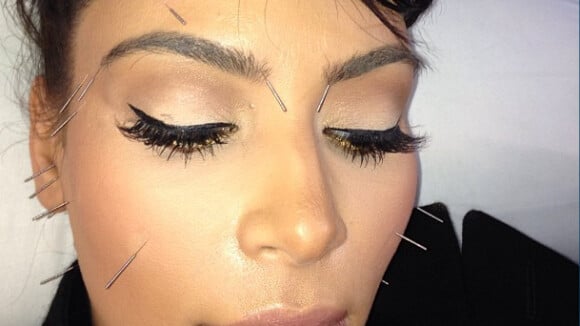 Kim Kardashian : après le "lifting vampire", les aiguilles dans le visage