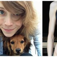 Une étudiante anorexique guérit de sa maladie grâce... à son chien