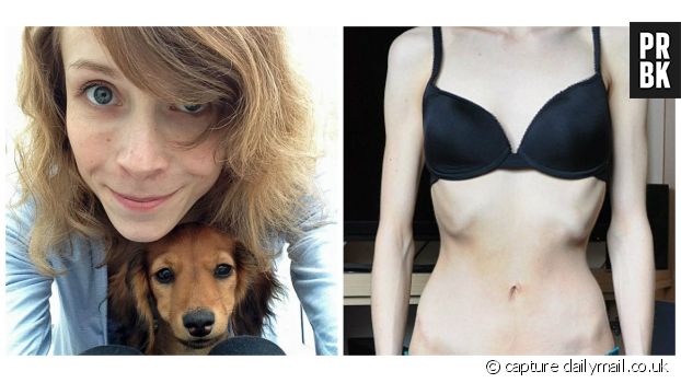 Un reportage sur Sophie et son   dachshund Eevee, qui lui a sauvé la vie en l&#039;incitant à manger.  