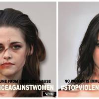 Kendall Jenner, Kristen Stewart, Emma Watson : défigurées pour sensibiliser aux violences conjugales