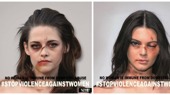 Kendall Jenner, Kristen Stewart, Emma Watson : défigurées pour sensibiliser aux violences conjugales
