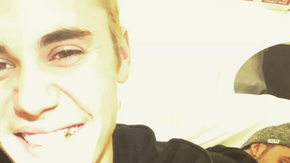 Justin Bieber se fait poser... une dent en or : ses fans choqués sur Twitter
