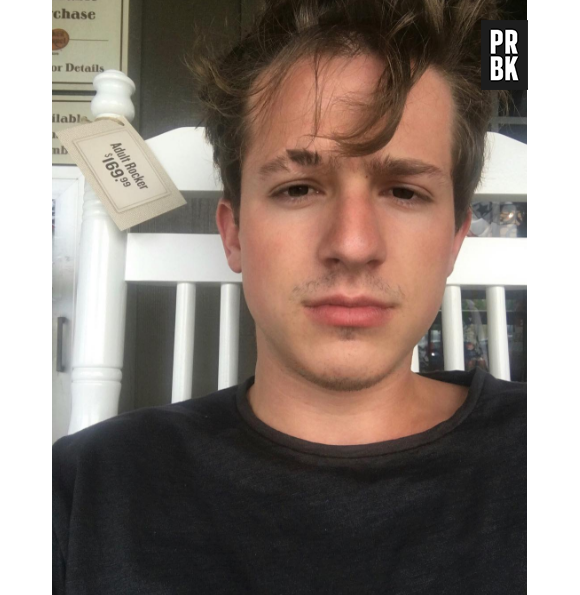 Charlie Puth : la vérité sur sa cicatrice à l'arcade sourcilière