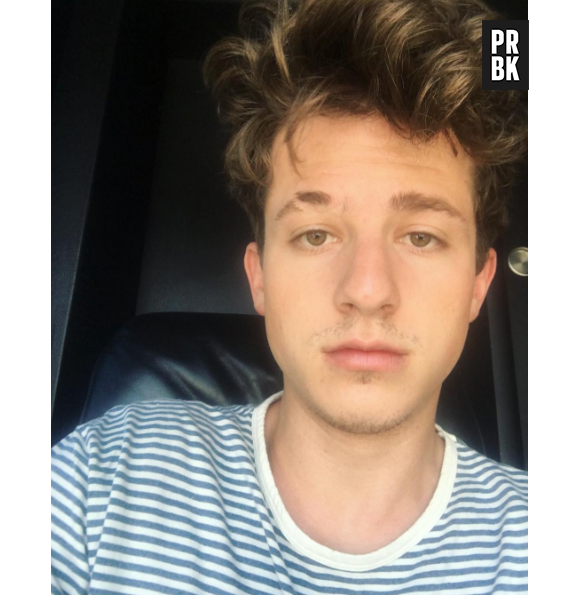 Charlie Puth : la vérité sur sa cicatrice à l'arcade sourcilière