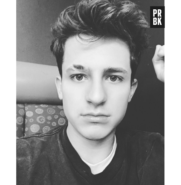 Charlie Puth : la vérité sur sa cicatrice à l'arcade sourcilière