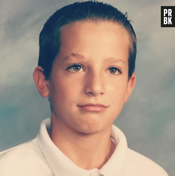 Charlie Puth : la vérité sur sa cicatrice à l'arcade sourcilière