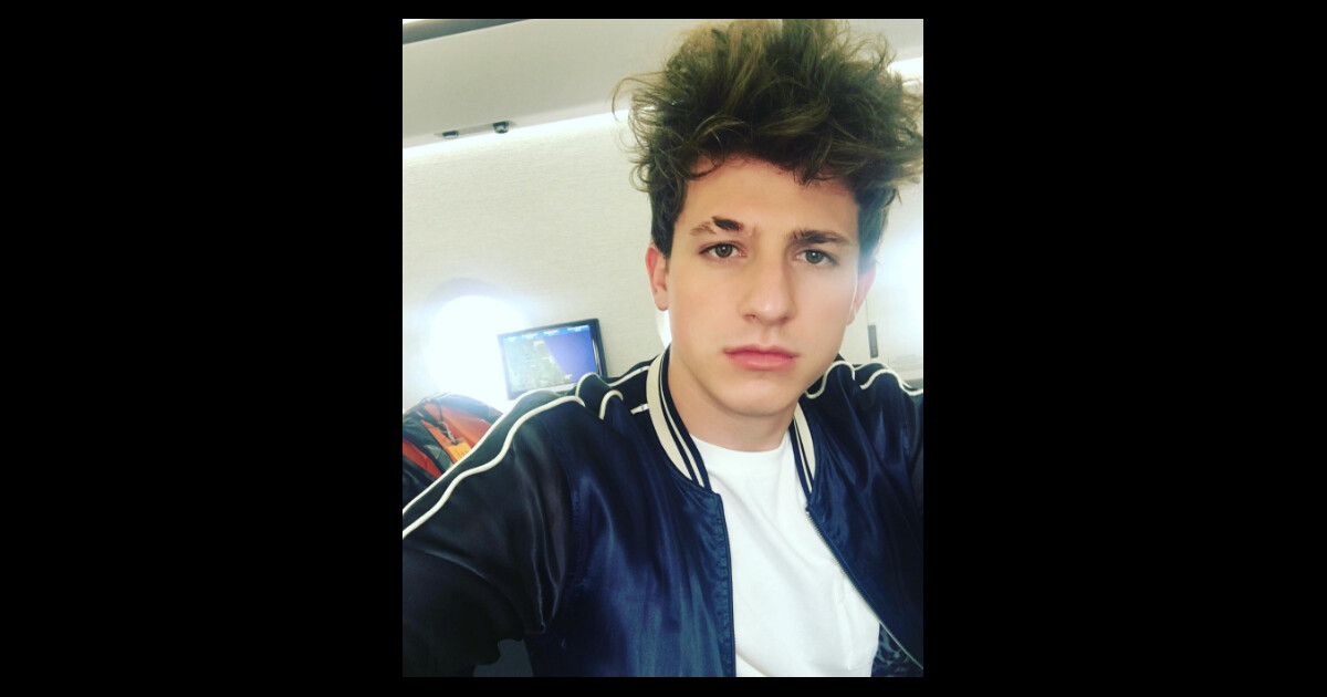Charlie Puth la vérité sur sa cicatrice à l