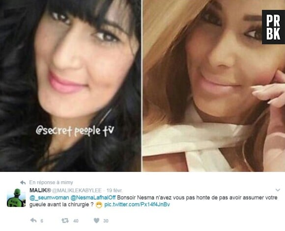 Nesma (Les Anges 9) avant-après : des photos dévoilées sur Twitter montrent qu'elle a peut-être eu recours à la chirurgie esthétique.