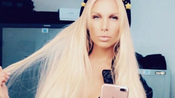 Adixia (Les Marseillais) : la chirurgie de trop ? Ses fans ne la reconnaissent plus