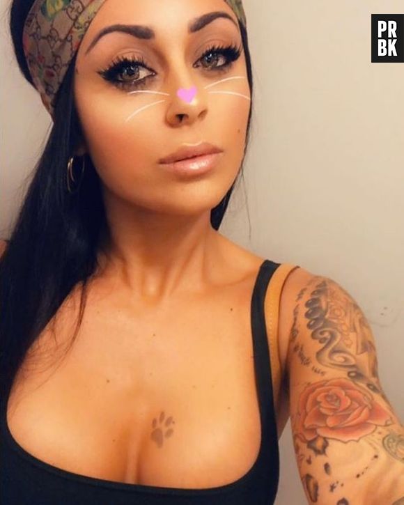 Shanna Kress (Les Anges 10) aux urgences : "je ne peux même pas mettre de vêtements, ça fait mal !"