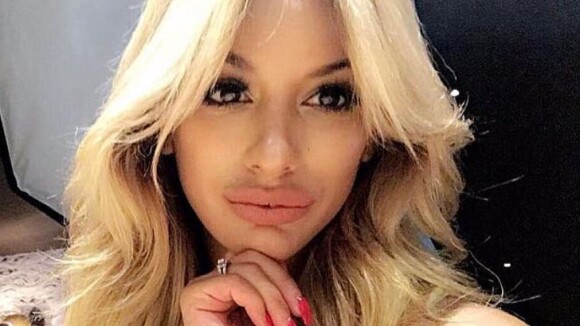 Sarah Martins (Les Anges 10) : accusée d'abus de chirurgie esthétique, elle répond en photo