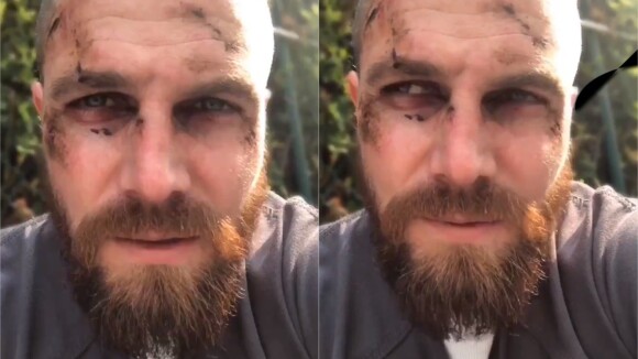 Arrow saison 7 : Stephen Amell souffre comme jamais sur le tournage, Oliver en danger ?