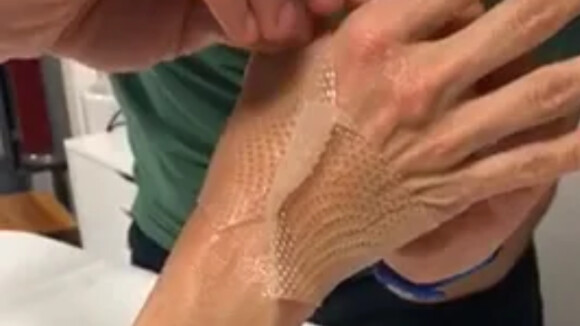 Pamela Anderson dévoile une vidéo de sa main blessée