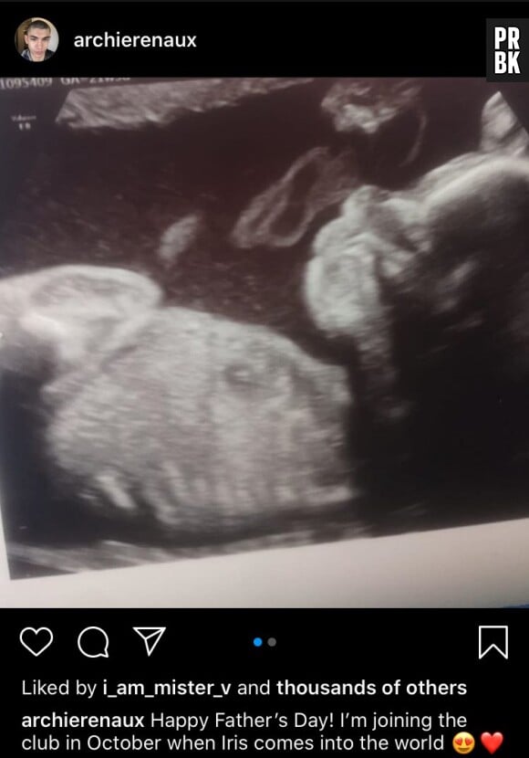 Archie Renaux avait annoncé qu'il allait être papa en juin 2020