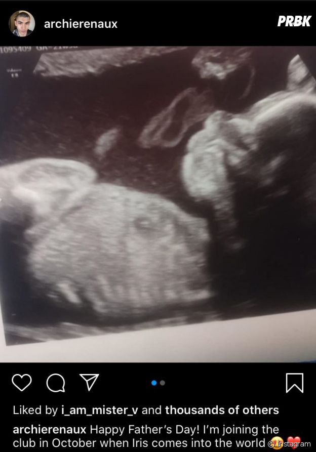 Archie Renaux avait annoncé qu'il allait être papa en juin 2020