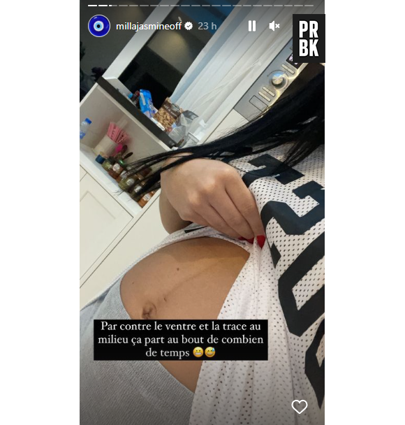 Milla Jasmine montre son ventre encore gonflé et sa ligne de grossesse. Une preuve qui met fin aux rumeurs