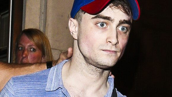 Daniel Radcliffe : sa tête de déterré ? C'est pour un rôle au théâtre